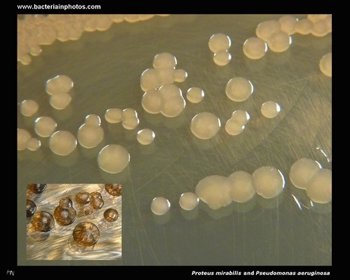proteus and pseudomonas on deoxycholate citrate agar
